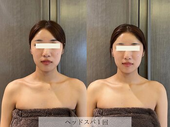 アージェム(AGEM)/【フェイシャル】ヘッドスパ