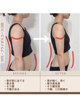 クロス(Cross)/ブライダルエステ10回