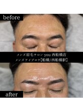 ユー 西船橋店(you)/ビフォーアフター写真