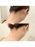 【女性】Wax脱毛（脇/胸/腰/うなじ/もみあげ/Iライン/Oライン)いずれか１箇所