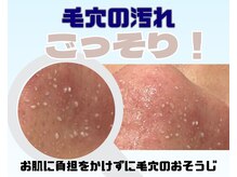 ルブレ 山形店(RUBURE)の雰囲気（気になる毛穴の汚れを徹底ケア◎いちご鼻にサヨナラ）