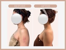 スリムライン 八戸店(The Slim Line)/before→after