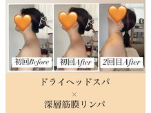 ラシネス(Racines)/ドライヘッドスパ×筋膜ケア