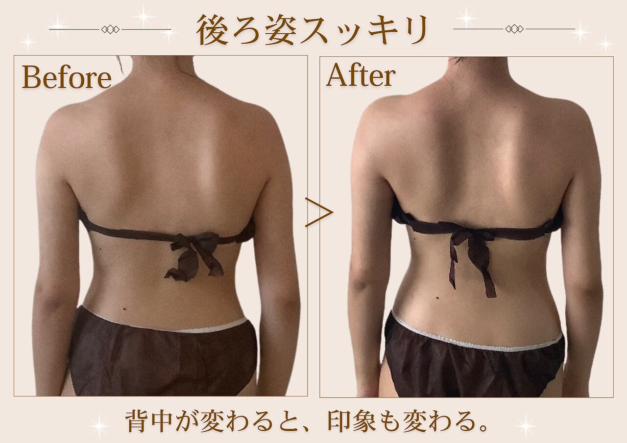 赤坂駅でキャビテーションが人気のエステサロン｜ホットペッパー