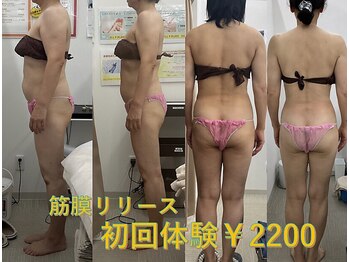 メリアミーゴ(Meli amigo)の写真/口コミ4.92☆痩身実績1800件越え初めての痩身エステにもブライダルにむけた痩身にも♪30分体験￥2200