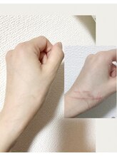 ブローディア(private estheticsalon Brodia)/あちち☆