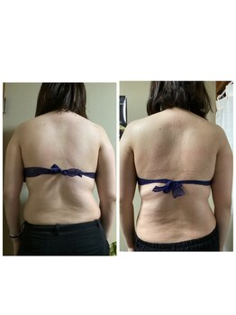 ブリリアント(Brilliant)/ブライダルエステ