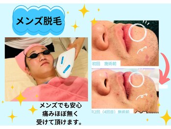ハピエルルーム(HAPPYEL ROOM)/メンズ脱毛。安心痛み少ない脱毛