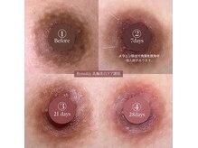 サロンドプレマージュ(Salon de Premage)の雰囲気（1回の施術とメラニンクリームで黒ずみケア！今話題の韓国発～）