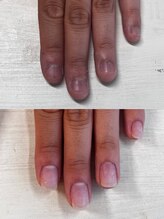 ヴェールリム(verl lim)/