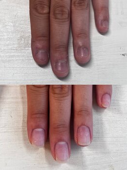 ヴェールリム(verl lim)/