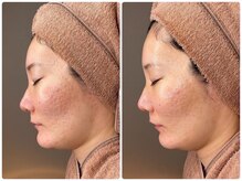 ホワイトアクア 京橋店(WHITE AQUA)/ララピール/京橋