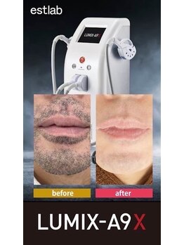 トッコ 清澄白河店(tocco)/脱毛