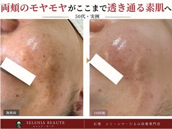 セレニア ボーテ(Selenia Beaute)の写真/もう探さない、迷わない。シミ・シワ悩みから解放される本気改善