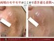 セレニア ボーテ(Selenia Beaute)の写真/もう探さない、迷わない。シミ・シワ悩みから解放される本気改善
