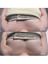 アロラヴィ(AroRavi)/BBLバスト