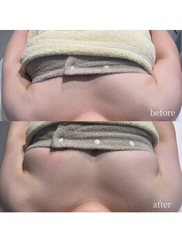 アロラヴィ(AroRavi)/BBLバスト