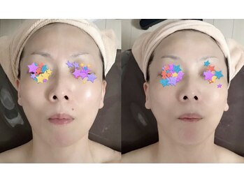 メディカルサロン かとれあ/5年振りの再会