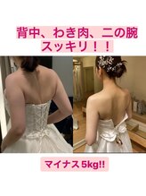 カビラ(KA美LA)/ドレスBefore After