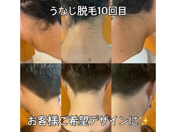 リエル(RIEL)/【うなじ脱毛】