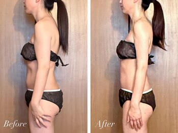 ラポーム 二子玉川(La paume)/深部リンパで巻き肩・猫背改善！