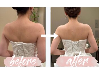 リシェカ(Richeka)/ブライダルエステ