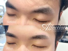 アフェクション アイビューティー(Affection eye beauty)/