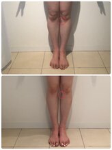 美人バスト 本厚木店/【痩身】症例☆