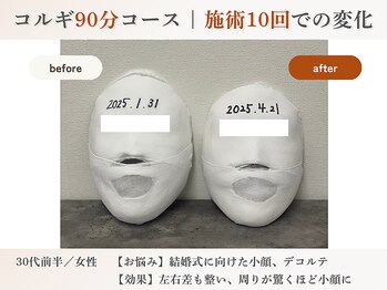 エルマ(elma)/コルギ90分before&after