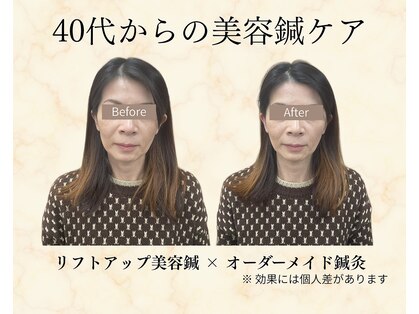 望鍼灸院の写真