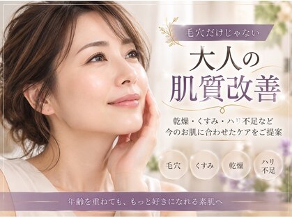 アンヘル(Angel)の写真
