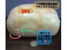 冷却した脂肪細⇒分解！老廃物の排出を促進するってどういう事？