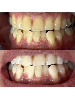 ライトビューティー 池袋店(LightBeauty)/症例写真