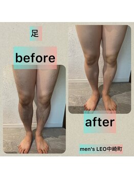 ランドマーク 中崎町(LANDMARK.)/《 足 》