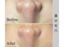 ブラックボックス(BLACK BOX)/ひたちなか市30代のお客様