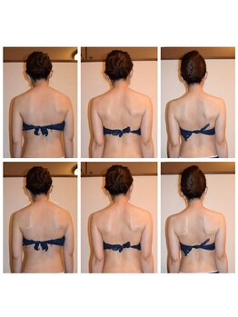 ピュアノア 垂水店/ブライダルエステ　神戸垂水明石