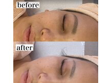 シーン(Sheen)/1回のくすみの変化