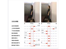 女性専用整体サロン　ベル 岩国店/ 【30代】姿勢Before After