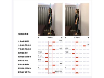 女性専用整体サロン　ベル 岩国店/ 【30代】姿勢Before After