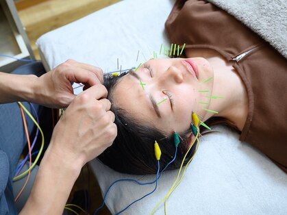 ナギ鍼灸院(nagi鍼灸院)の写真