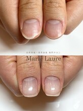 マリーロール 淀屋橋本店(Marie Laure)/自爪育成/深爪矯正/ネイルケア