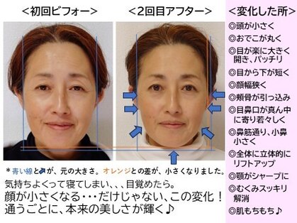 エピファニー(Epiphany)の写真