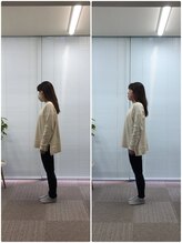 カルペード 中百舌鳥/なかもず院(Carpe D.)/施術後の変化