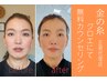 【お顔の土台からしっかり補強！】無料カウンセリングでお気軽来店