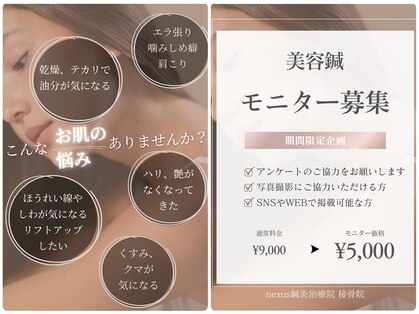 ネクサス(NEXUS)の写真