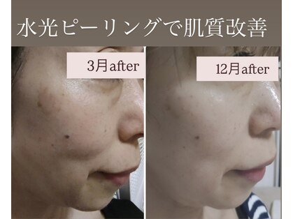 ピュルテの写真