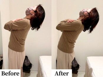 ソレア(Solea)/腰痛改善1回目