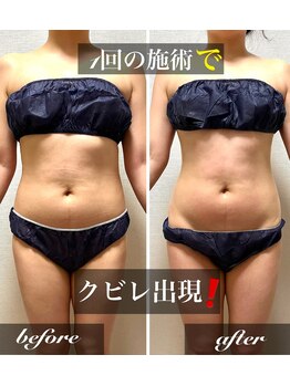 ラ マジ(La Magie)/