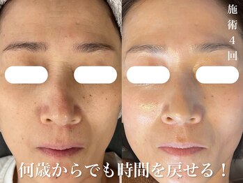 ダン(dan)/【陶肌トリートメント】症例