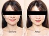 【美容整体】モニター価格◎！小顔矯正　20分　¥4400→¥3300